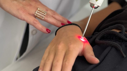 Acupuntura a Laser em curitiba Carla Helmer