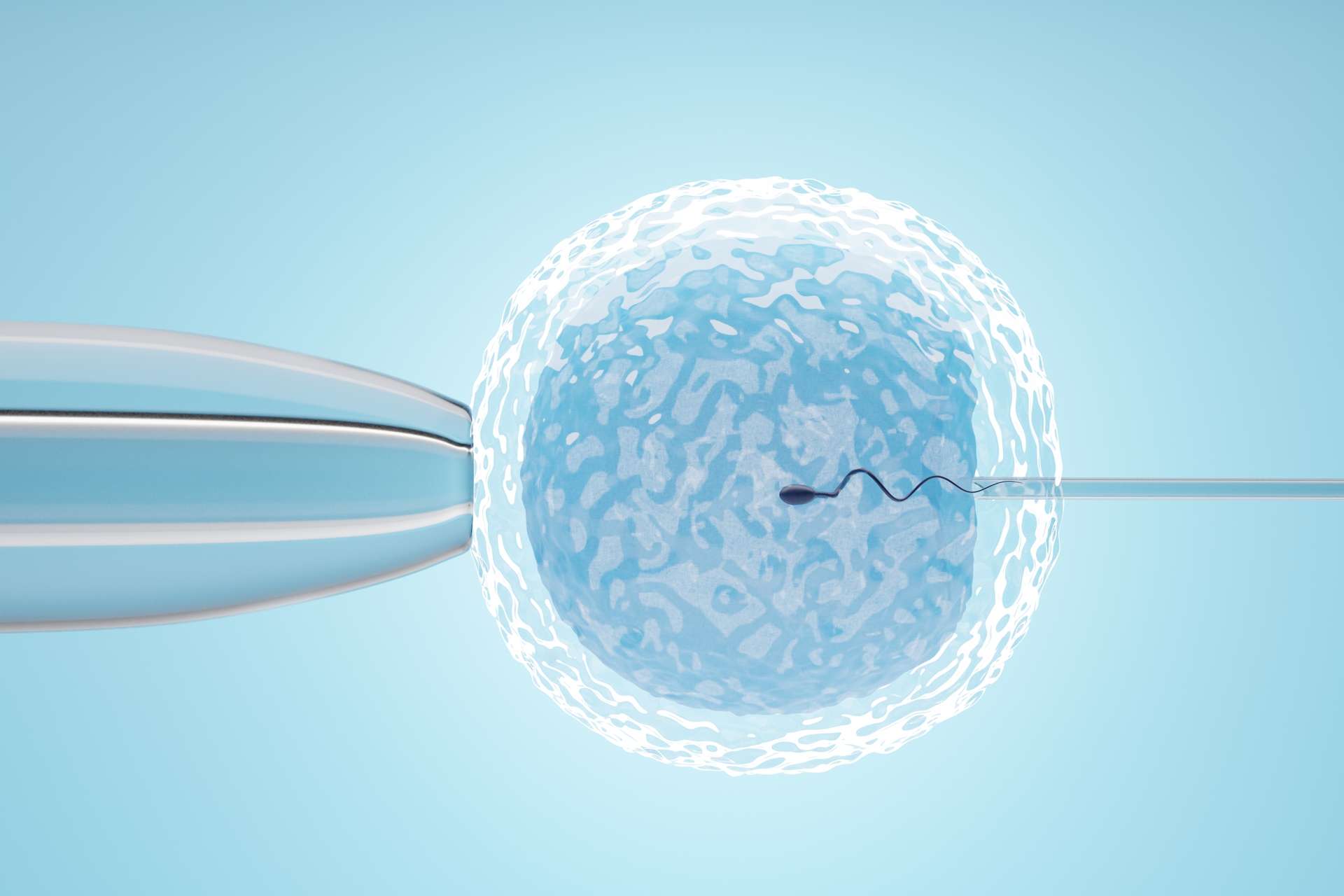 Acupuntura auxiliando a reprodução assistida FIV