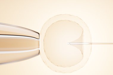 Protocolo de Paulus em Curitiba